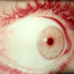 Eyes