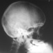 L'Atome au Service de la Paix "Atome et Médecine"
