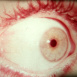 Eyes